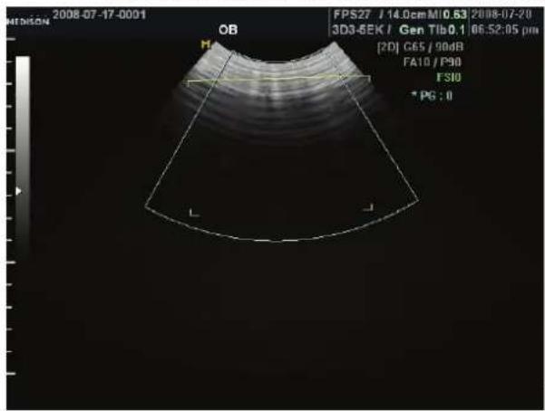 2008-07-17-0091 FPS27 / 14.0cm M10.63 2008-07-20 3D3-BEK / Gen Tlb0.1 06:52:05 pm [2D] C65 / 90dB FA10 / P90 FS10 * PG : 0