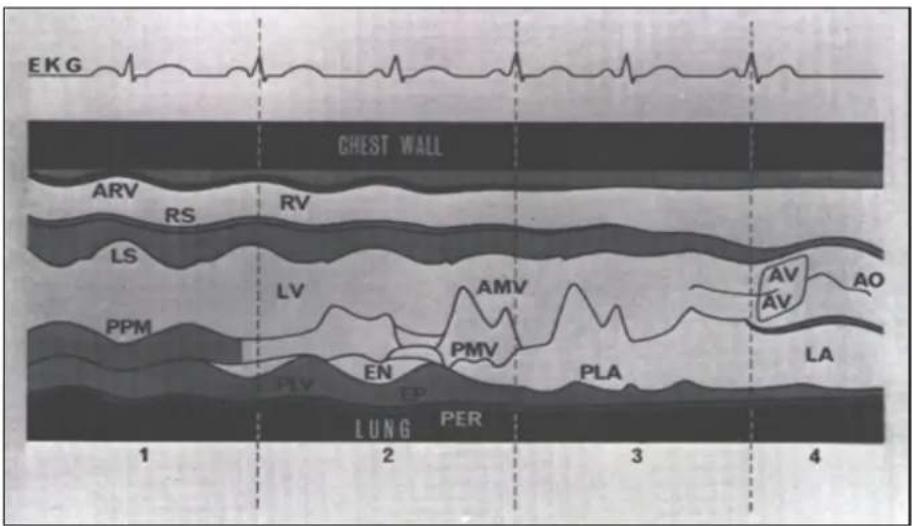 EKG CHEST WALL ARV RS RV LS LV AMV PPM PLV EN PMV LA LUNG PER 1 2 3 4
