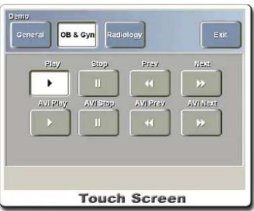 Demo General OB & Gyn Radiology Exit Play Stop Prev Next AVI Play AVI Stop AVI Prev AVI Next Touch Screen