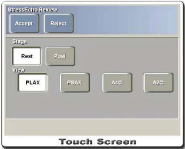 StressEcho Review Accept Reject Stage Rest Post View PLAX PSAX A1C A2C Touch Screen