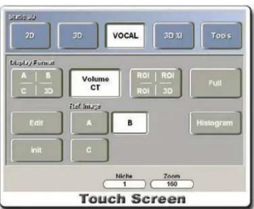 Static 3D 2D 3D VOCAL 3D XI Too's Display Format A B Volume CT ROI ROI Full C 3D ROI ROI 3D Ref. Image Edit A B Histogram Init C Niche Zoom 1 160 Touch Screen