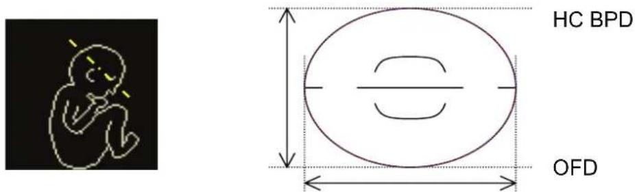 SAMSUNG Accuvix XQ - Measurement Points - 1