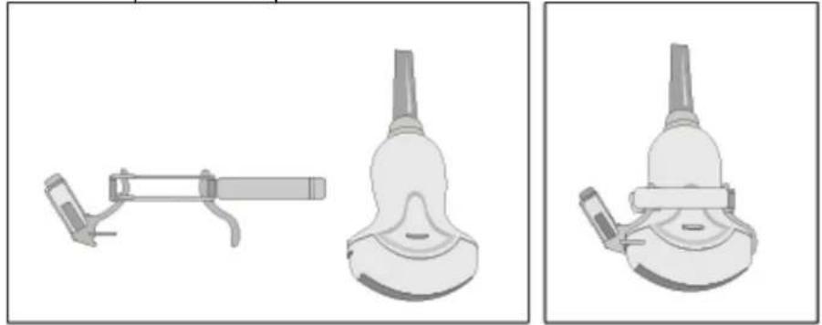 SAMSUNG Accuvix XQ - Fill the sheath with the ultrasound gel. - 2