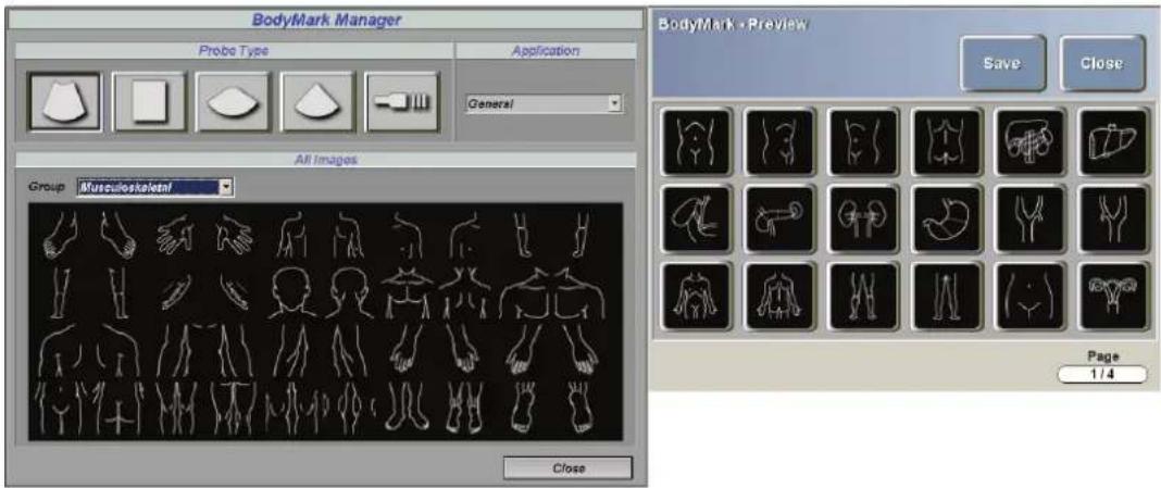 BodyMark Manager Probe Type Application General All Images Group Musculoskeletal Close BodyMark - Preview Save Close Page 1/4