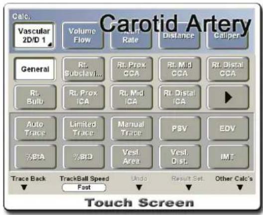 Calc. Vascular 2D/D 1 Volume Flow Aunt Rate Distance Caliper General Rt. Subclavi... Rt. Prox. CCA Rt. Mid CCA Rt. Distal CCA Rt. Bulb Rt. Prox. ICA Rt. Mid ICA Rt. Distal ICA Auto Trace Limited Trace Manual Trace PSV EDV %BtA %BD Vest. Area Vest, Dist. IMT Trace Back TrackBall Speed Fast Undo Result Set. Other Calc's Touch Screen
