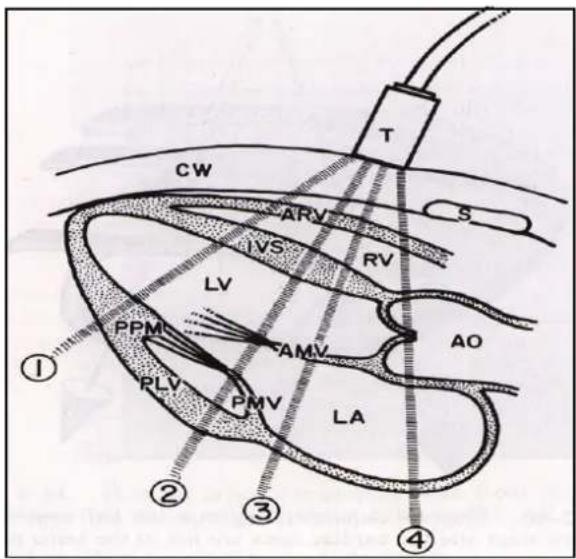 CW ARV IVS RV LV PPM AMV AO PLV PMV LA ① ② ③ ④