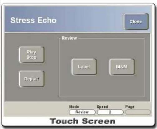 Stress Echo Close Play Stop Report Review Label! M&M Mode Review Speed 2 Page Touch Screen