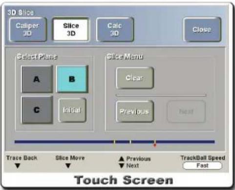 3D Slice Caliper 3D Slice 3D Calc 3D Close Select Plane A B C Initial Slice Menu Clear Previous Next Trace Back Slice Move Previous Next TrackBall Speed Fast Touch Screen