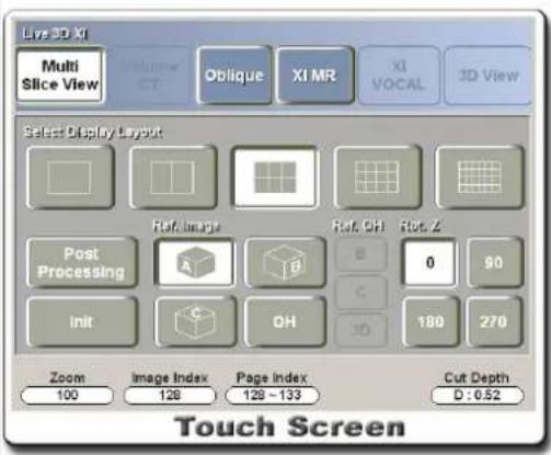Live 3D XI Multi Slice View Volume CT Oblique XI MR XI VOCAL 3D View Select Display Layout Ref: Image Ref: CH Rot: Z Post Processing A B C D 180 270 Zoom 100 Image Index 128 Page Index 129 ~ 133 Cut Depth D : 0.52 Touch Screen