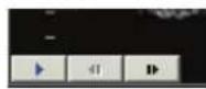 SAMSUNG Accuvix XQ - Cine Mode - 1