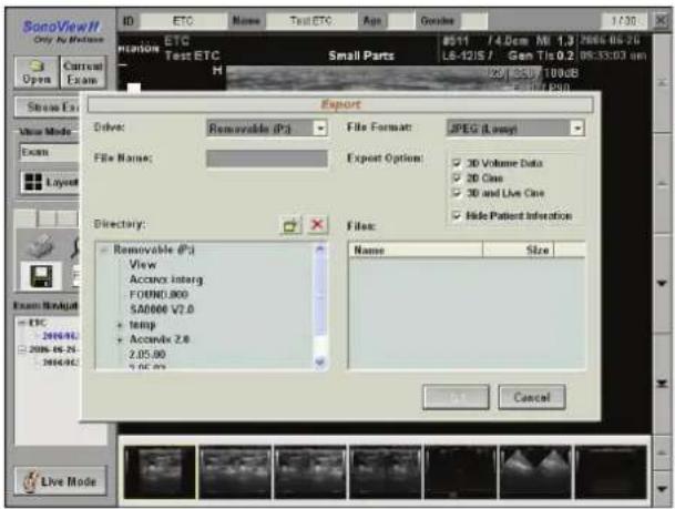 SonoView H Only Av License Operation: ETC Test ETC Small Parts H 1/30 LE-12/15 / Gen Tis 0.2 08:33:03 am 025/13:07 100dB Export Drive: Removable (P3) File Format: JPEG (Layer) File Name: Export Options: 3D Volume Data 3D Case 3D and Live Case Hide Patient Information Directory: Files: Removable (P3) View Accrscs interg FOENO.000 5A0000 V2.0 temp Accrscs 2.0 2.05.00 5.05.00 Name Size OK Cancel Live Mode