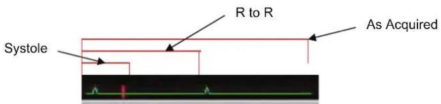 R to R As Acquired Systole