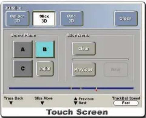 3D slice Caliper 3D Slice 3D Calc 3D Close Select Plane A B C Initial Slice Menu Clear Previous Next Trace Back Slice Move ▲ Previous ▼ Next TrackBall Speed Fast Touch Screen