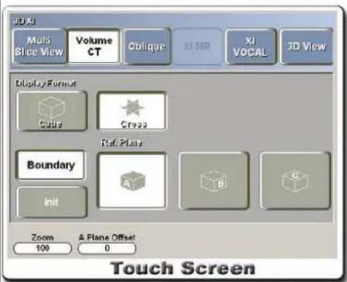 3D X1 Multi Slice View Volume CT Oblique XI MR XI VOCAL 3D View Display Format Cube Cross Ref. Plans Boundary Init Zoom & Plane Offset 100 0 Touch Screen