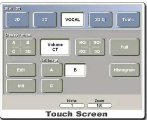 Static 3D 2D 3D VOCAL 3D XI Tools Display Format A B Volume CT ROI ROI Full C 3D ROI 3D Ref Image Edit A B Histogram Init C Niche Zoom 1 160 Touch Screen