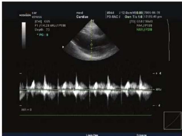 Mccosin Ear stress med Cardize 0944 / 12.0cm M10.05 2005-06-26 P3-SAC / Gen Tis 18 / 12:05:40 pm [GW] 0.05 F1 / 14.29 kHz / F100 Depth: 73 * PG : 8 [20] GSIB / SIBIB FM4 / F100 HAR / FSIB - + 4 - Hz - - 4 HR = 0 Loop Pos Freeze