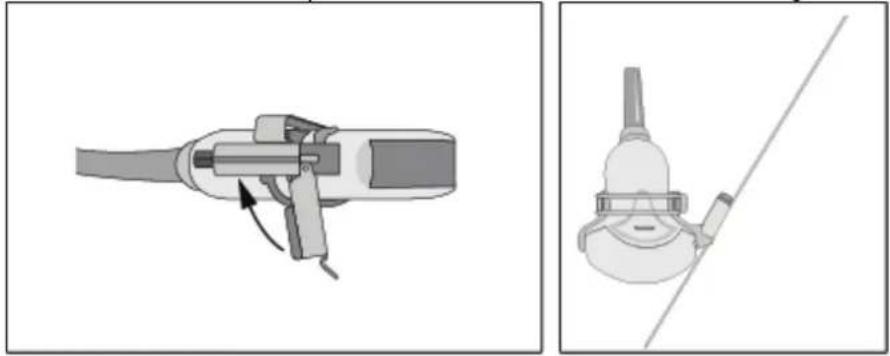 SAMSUNG Accuvix XQ - Fill the sheath with the ultrasound gel. - 3