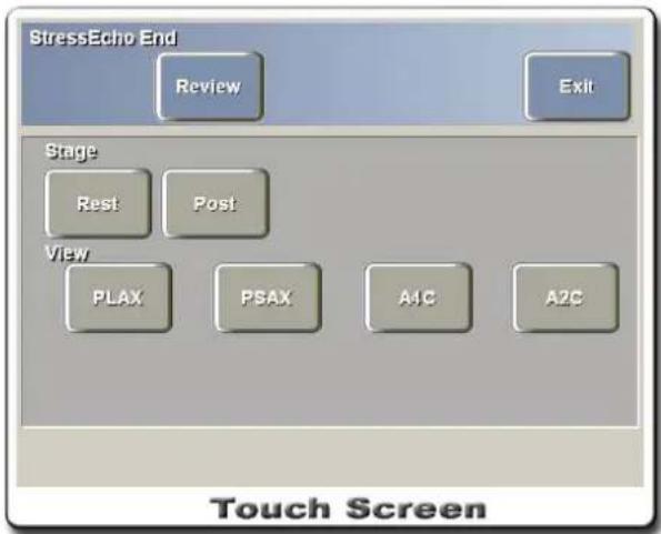 StressEcho End Review Exit Stage Rest Post View PLAX PSAX A1C A2C Touch Screen