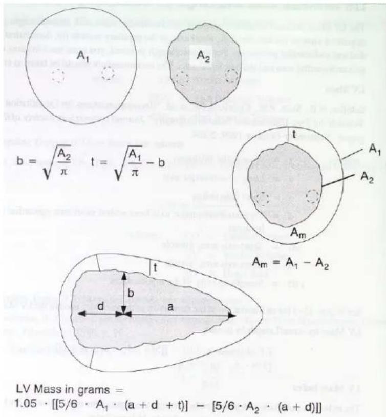 A₁ A₂ b = √(A₂/π) t = √(A₁/π) - b Aₘ A₁ A₂ Aₘ = A₁ - A₂ LV Mass in grams = 1.05 · [[5/6 · A₁ · (a + d + t)] - [5/6 · A₂ · (a + d)]]