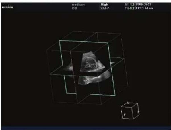 SAMSUNG Accuvix XQ - Cross Volume CT - 1