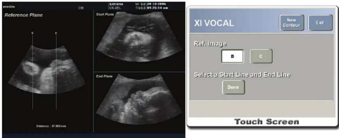 Reference Plane S E Distance : 37.865mm Start Plane End Plane XI VOCAL New Contour Exit Ref. Image B C Select a Start Line and End Line: Done Touch Screen