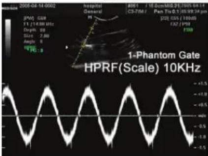 2005-04-14 00:02 JW1: 3.68 E1: 21.680 MHz Days: 99 Size: 2.88 Angle: 8 HPG: 8 Hospital General JW1 / 16.000/00:31 1995 04 14 CS-76M J Pen Tio: 0.1 05:09:34 pm P28: 0.55 / 100dB C22: 1998 HPRF 1-Phantom Gate HPRF(Scale) 10KHz
