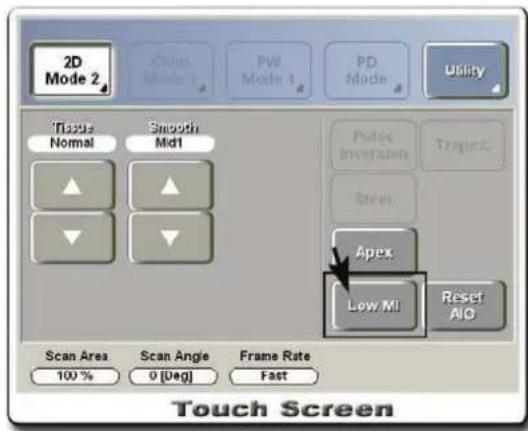 2D Mode 2 Color Mode 1 PW Mode 1 PD Mode Utility Tiscus Normal Smooth Mid1 Pulse Inversion Trapies Stress Apex Low MI Reset AIO Scan Area Scan Angle Frame Rate 100% 0 [Deg] Fast Touch Screen