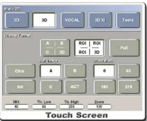 Static 3D 2D 3D VOCAL 3D XI Tools Display Format A B ROI ROI C 3D ROI 3D Full Flat Image Orientation Cine A B 0 90 Init C ACT 180 270 MIX Th. Low Th. High Zoom 40 60 255 130 Touch Screen