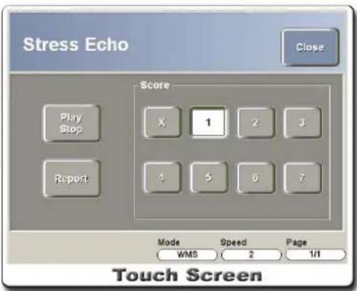Stress Echo Close Play Stop Report Score X 1 2 3 4 5 6 7 Mode Speed Page WMS 2 1/1 Touch Screen