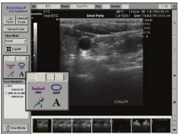 SonoView H Only by Modulus Posterior ETC Test ETC Small Parts 80-11 / 4.0cm MI 1.3 2006-06-25 LS-12IS / Gen Tis 0.2 09:33:03 am H 20/11/17 100µm T - P / P90 PSII SCDL * PC : 0 Exon Navigator ETC 2006-06-29 2006-06-25 000 2006-06-29 Eco Mode Eco Eco Eco SCILOW