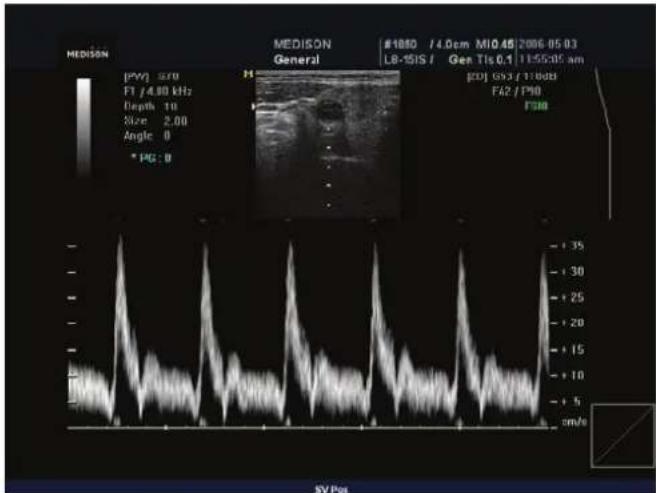 MEDISON General #1850 /4.0pm M10.45 2006-05-03 L6-ISIS / Gen TIs 0,1 /15:55:05 am [FW] S70 FT /4.80 kHz Depth 10 Size 2.00 Angle 0 * PG: 0 pDJ GS3 /11:00 FA2 /P10 FSM SV Pos