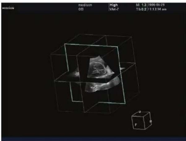 SAMSUNG Accuvix XQ - Cross Volume CT - 1