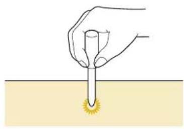 BABY LOCK Esante - Lower the needle into the fabric at the beginning of the stitching, lower the presser foot lever, and then start sewing. - 2