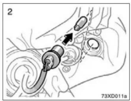 Medical illustration showing a mechanical device with an arrow indicating a specific point, no text or symbols present.