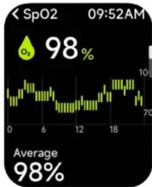 Kogan Active 4 Pro - Noise - 2