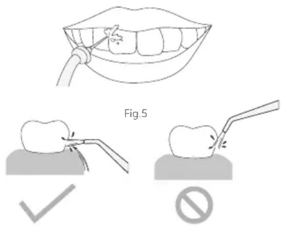 Fig.5