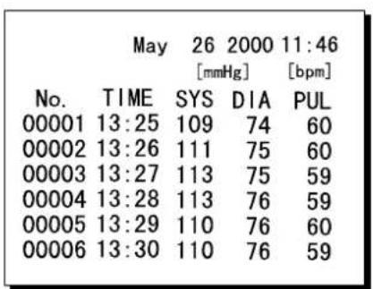 May 26 2000 11:46 [mmHg] [bpm] No. TIME SYS DIA PUL 00001 13:25 109 74 60 00002 13:26 111 75 60 00003 13:27 113 75 59 00004 13:28 113 76 59 00005 13:29 110 76 60 00006 13:30 110 76 59