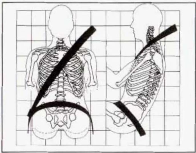 Illustration of human torso and pelvis with a belt, shown from front and side views (no text or labels)