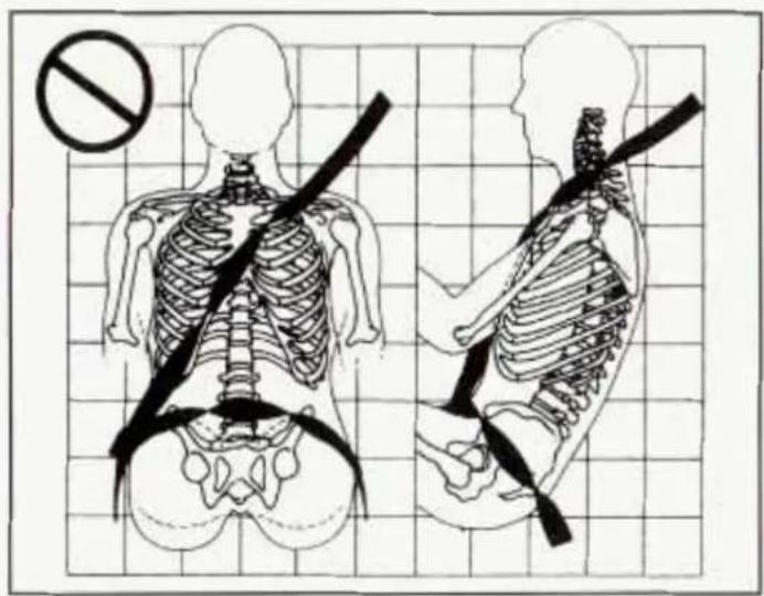Medical illustration showing human skeletal anatomy with a no-smoking symbol and a cross-section of the lower torso.