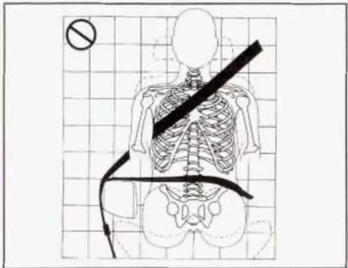 Diagram of human skeleton with a diagonal band crossing it, marked with a no-approval symbol and a diagonal line.