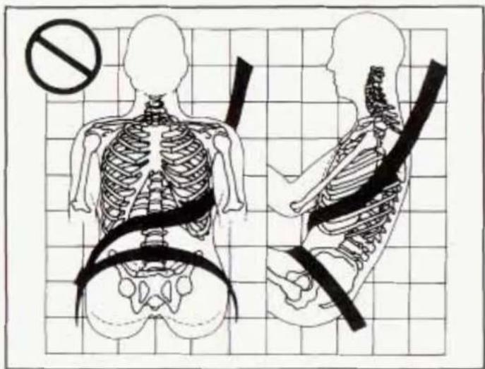 Medical diagram showing human skeletal anatomy with a no-smoking symbol and corresponding side views of the spine and lower back.