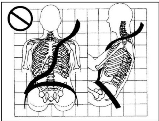 Medical diagram showing human skeletal anatomy with a no-smoking symbol and corresponding side views of the human torso.