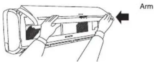 Arm