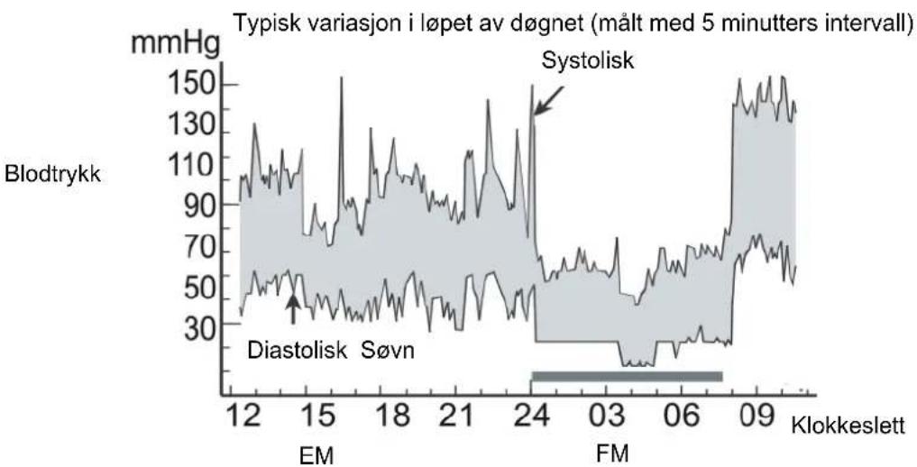 Marquant 880-140 - Blodtrykksvariasjoner - 1