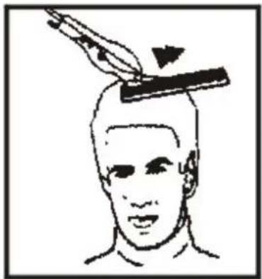 Marquant 804-005 - Step 4 – top of the head - 3
