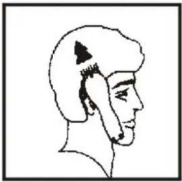 Marquant 804-005 - Step 1 – back of the neck - 3
