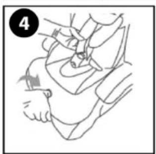 Line drawing of a person performing a medical procedure on another person's neck (no text or symbols)