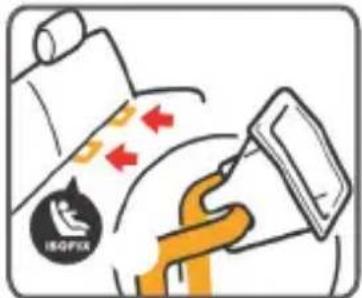 Diagram illustrating a medical procedure with labeled components and directional arrows indicating movement or force.