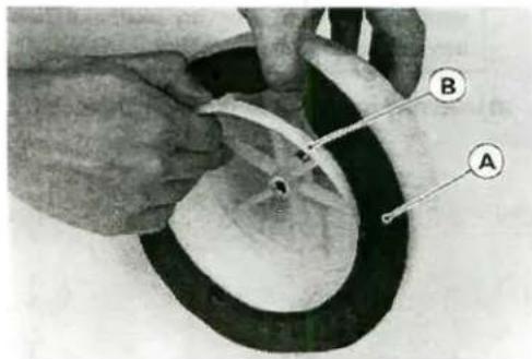 Medical procedure image showing hands operating a medical device with labeled parts A and B