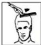 Innoliving INN-616 - STEP 4 - TOP OF THE HEAD - 3